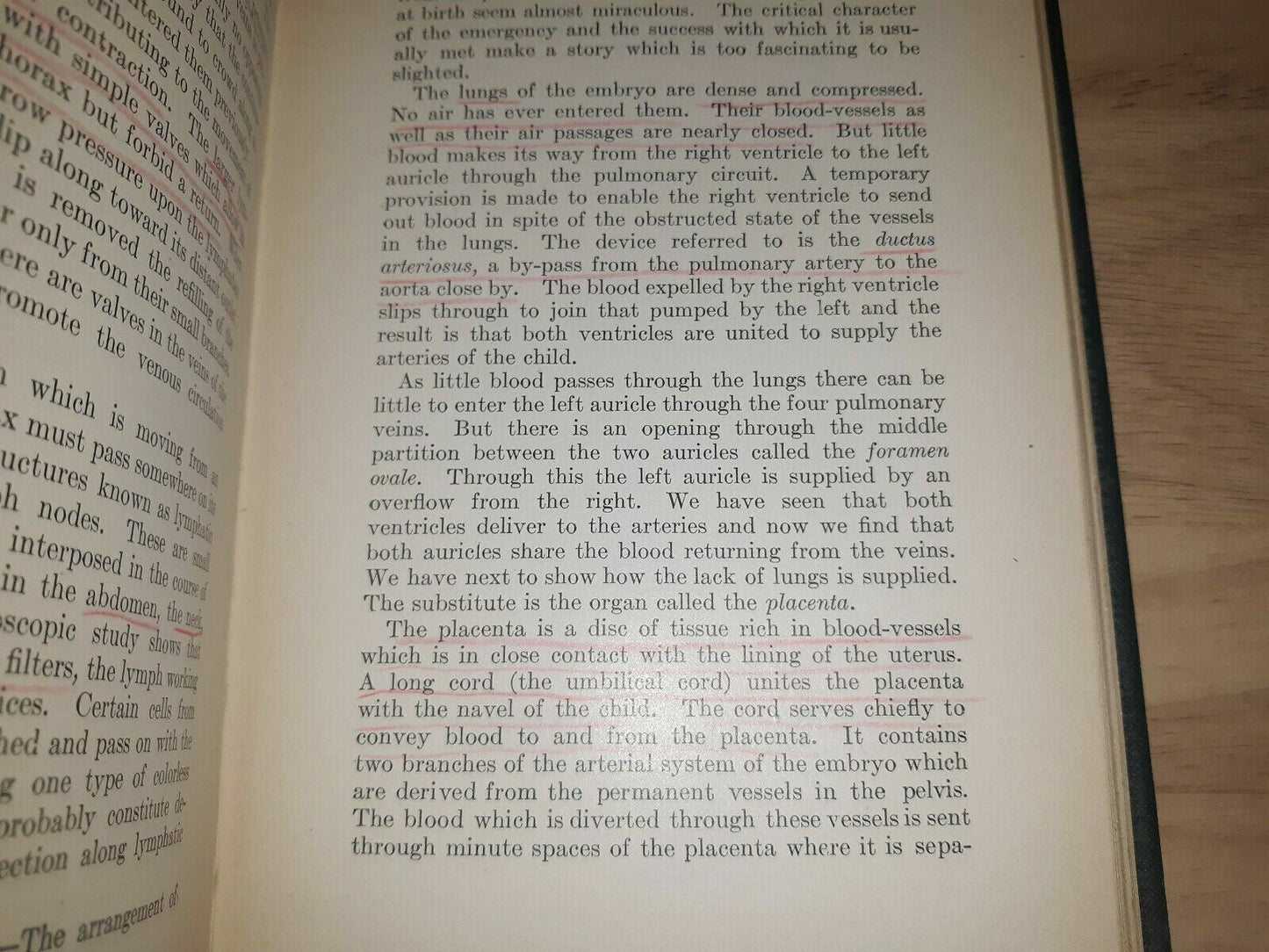 Image #11