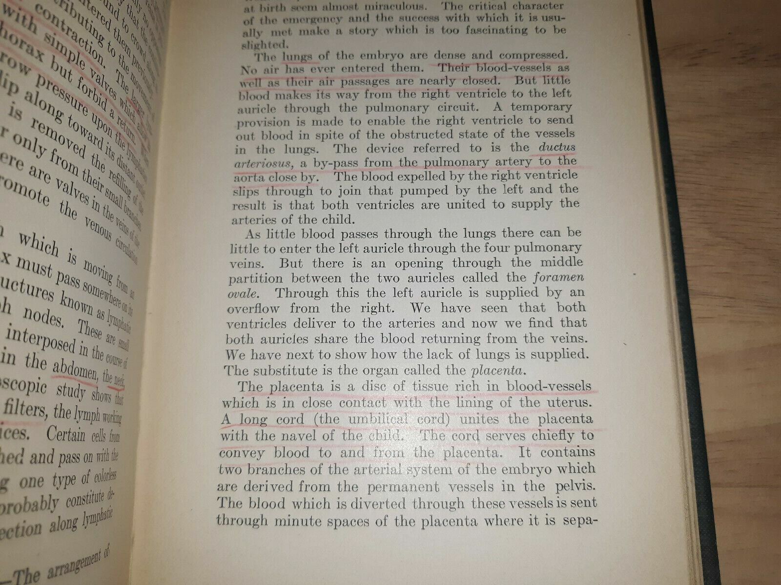Image #11