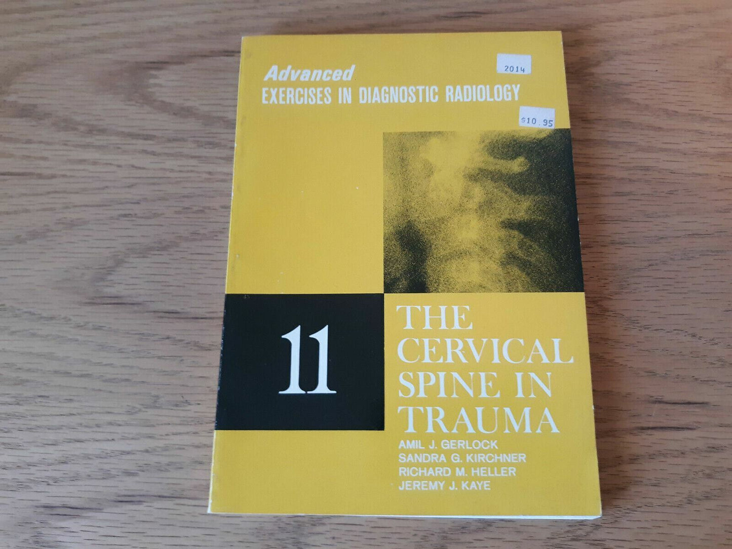 Advanced Exercises in Diagnostic Radiology Vol 11 The Cervical Spine in Trauma